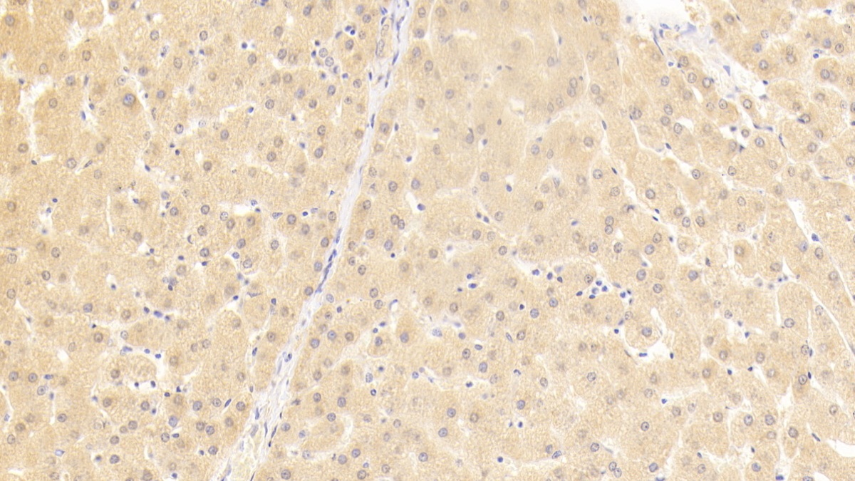 Polyclonal Antibody to Killer Cell Immunoglobulin Like Receptor 2DL5 (KIR2DL5)