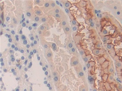 Polyclonal Antibody to Killer Cell Immunoglobulin Like Receptor 2DS2 (KIR2DS2)