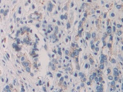 Polyclonal Antibody to Killer Cell Immunoglobulin Like Receptor 2DL2 (KIR2DL2)