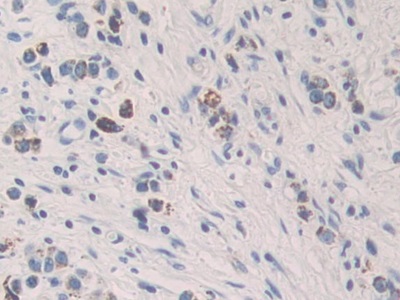 Polyclonal Antibody to Killer Cell Immunoglobulin Like Receptor 2DL2 (KIR2DL2)