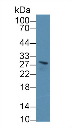 Polyclonal Antibody to Bisphosphoglycerate Mutase (BPGM)