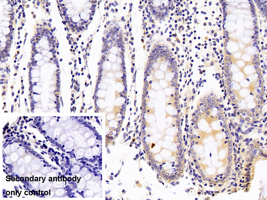 Polyclonal Antibody to Apolipoprotein L (APOL1)