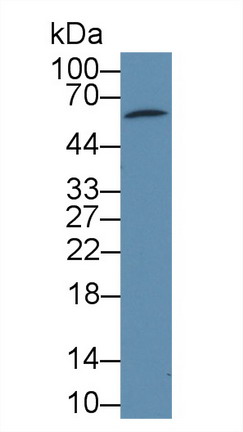 Polyclonal Antibody to Pyruvate Dehydrogenase Phosphatase 2 (PDP2)