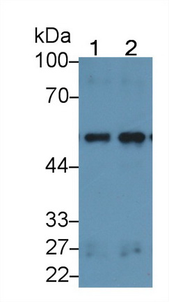 Polyclonal Antibody to Lipolysis Stimulated Lipoprotein Receptor (LSR)