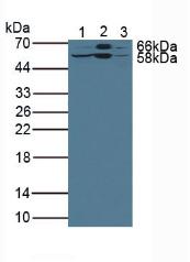 Polyclonal Antibody to Lipolysis Stimulated Lipoprotein Receptor (LSR)