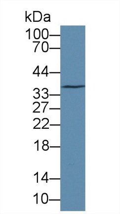 Polyclonal Antibody to Low Density Lipoprotein Receptor Related Protein 11 (LRP11)