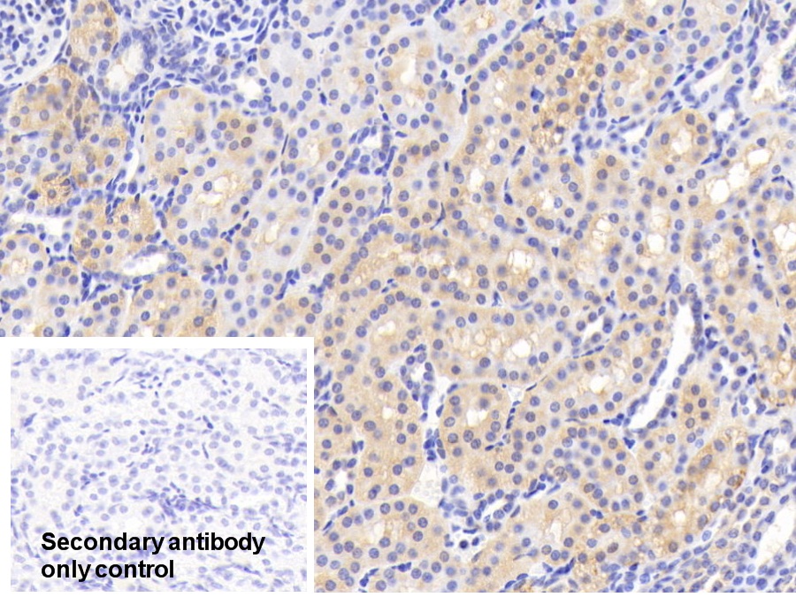 Polyclonal Antibody to Glutathione Synthetase (GSS)