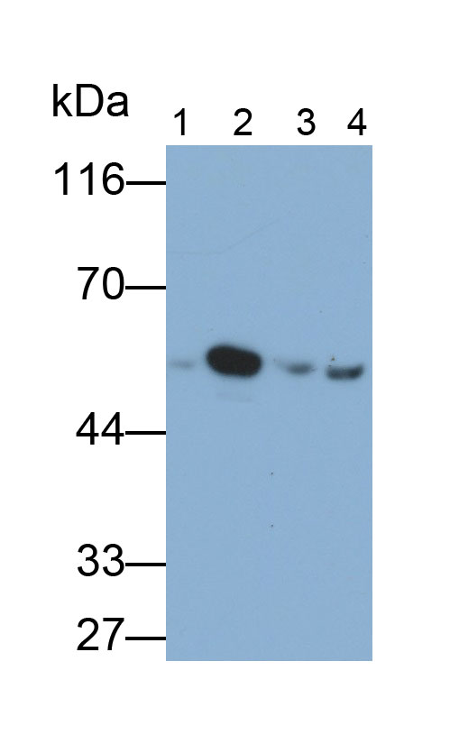 Polyclonal Antibody to Glutathione Synthetase (GSS)