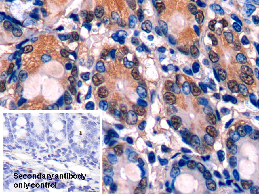 Polyclonal Antibody to Glutathione Synthetase (GSS)