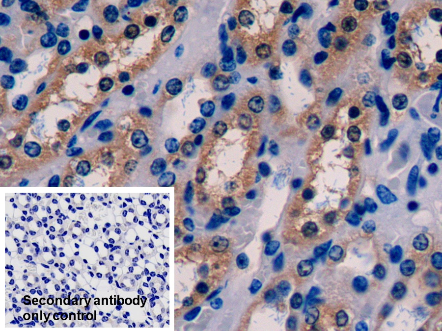 Polyclonal Antibody to Glutathione Synthetase (GSS)