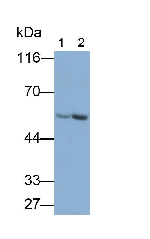 Polyclonal Antibody to Glutathione Synthetase (GSS)