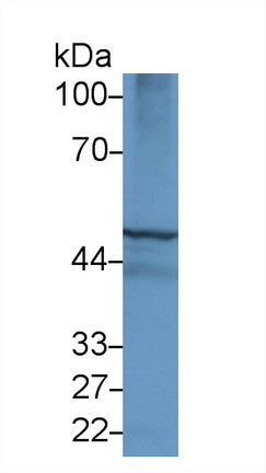 Polyclonal Antibody to Glutathione Synthetase (GSS)