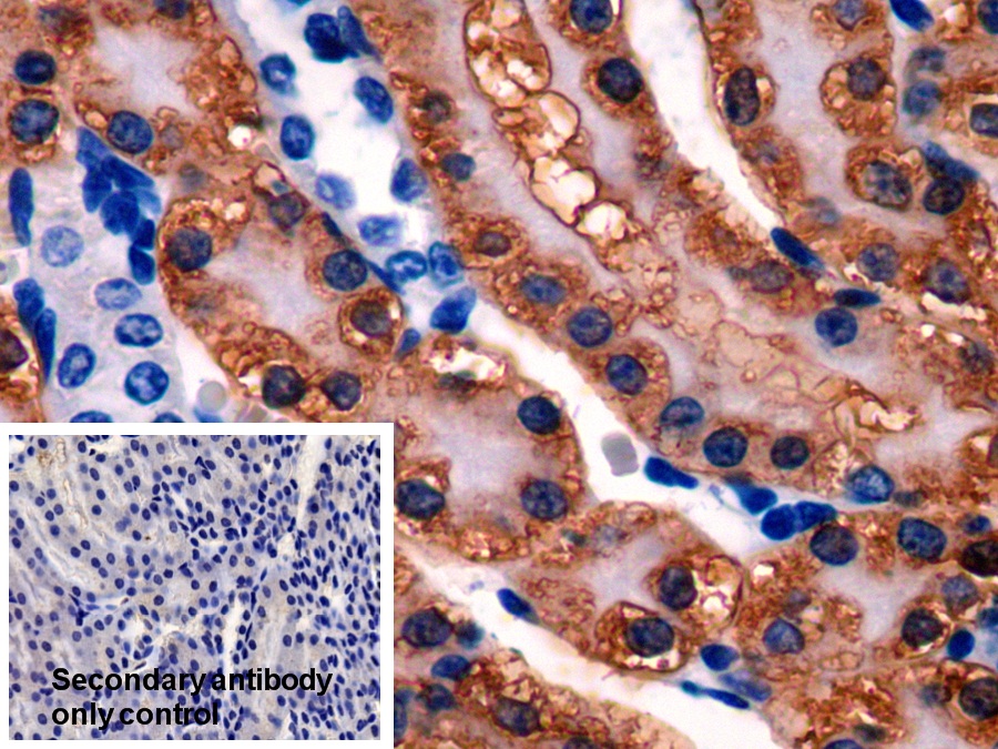 Polyclonal Antibody to Glutathione Synthetase (GSS)