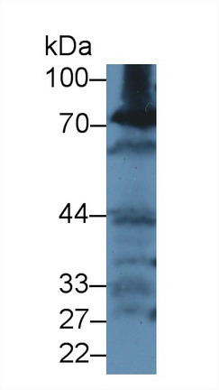 Polyclonal Antibody to Glutamate Cysteine Ligase, Catalytic (GCLC)