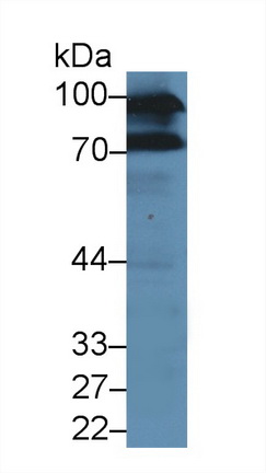 Polyclonal Antibody to Glutamate Cysteine Ligase, Catalytic (GCLC)