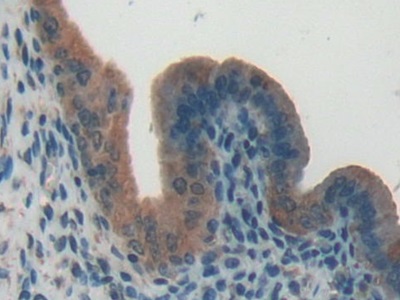 Polyclonal Antibody to Glutamate Cysteine Ligase, Catalytic (GCLC)