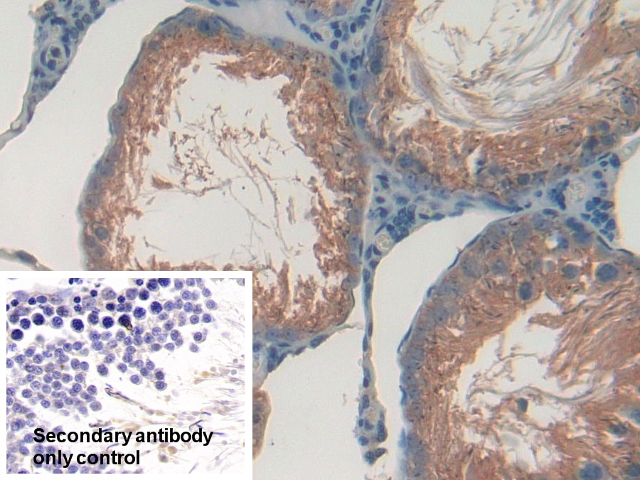 Polyclonal Antibody to Glutamate Cysteine Ligase, Catalytic (GCLC)