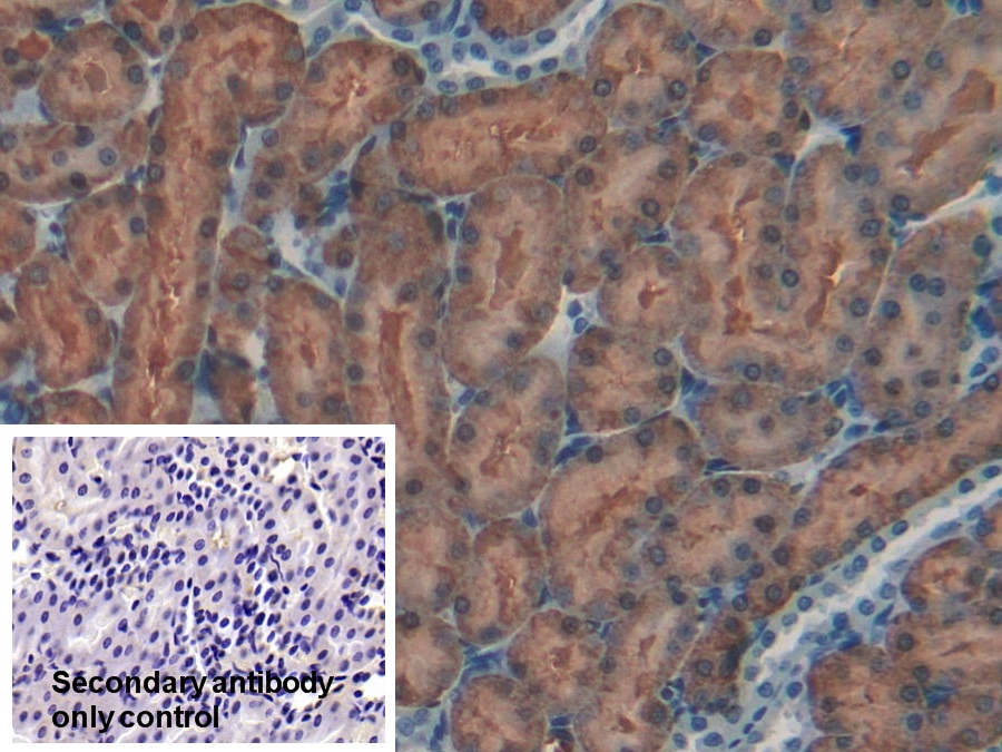 Polyclonal Antibody to Glutamate Cysteine Ligase, Catalytic (GCLC)