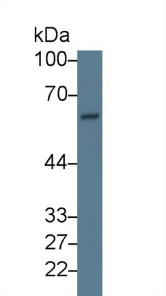 Polyclonal Antibody to Asparagine Synthetase (ASNS)