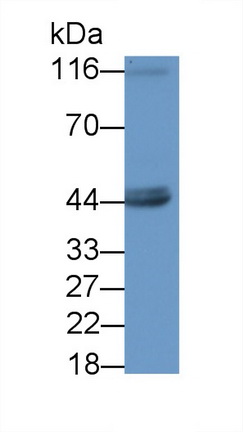 Polyclonal Antibody to Glutamine synthetase (GS)