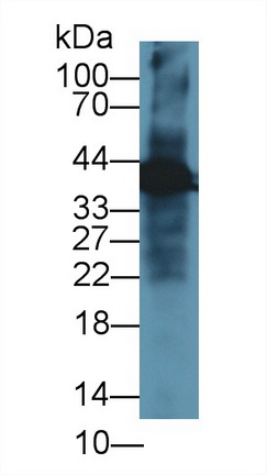 Polyclonal Antibody to Glutamine synthetase (GS)