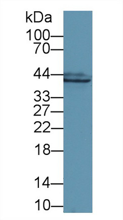 Polyclonal Antibody to Glutamine synthetase (GS)