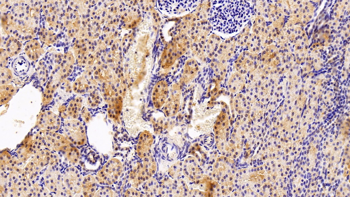 Polyclonal Antibody to Arginine Vasopressin Induced Protein 1 (AVPI1)