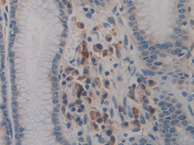 Polyclonal Antibody to Preprovasopressin (VP)