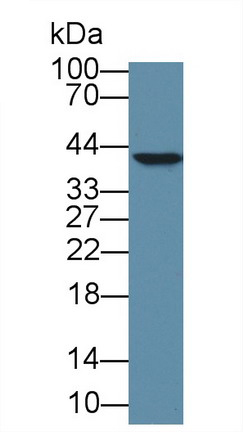 Polyclonal Antibody to High Mobility Group Protein 20B (HMG20B)