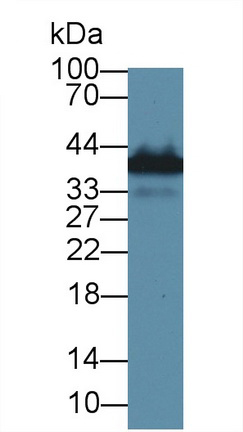 Polyclonal Antibody to High Mobility Group Protein 20B (HMG20B)