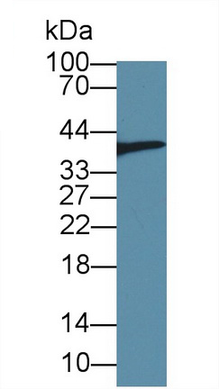 Polyclonal Antibody to High Mobility Group Protein 20B (HMG20B)