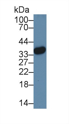 Polyclonal Antibody to High Mobility Group Protein 20B (HMG20B)