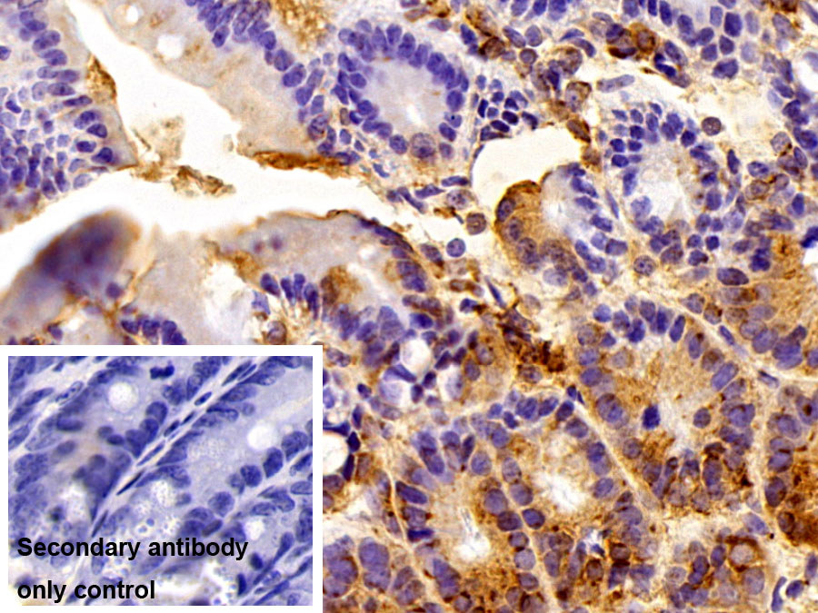 Polyclonal Antibody to Protein Disulfide Isomerase A4 (PDIA4)