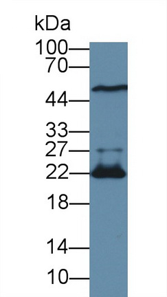 Polyclonal Antibody to Deoxythymidylate Kinase (DTYMK)