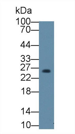 Polyclonal Antibody to Deoxythymidylate Kinase (DTYMK)