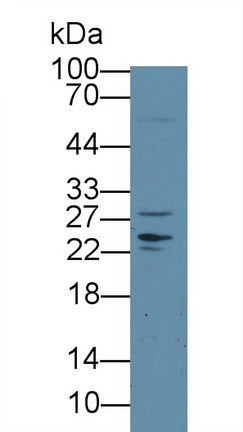 Polyclonal Antibody to Deoxythymidylate Kinase (DTYMK)