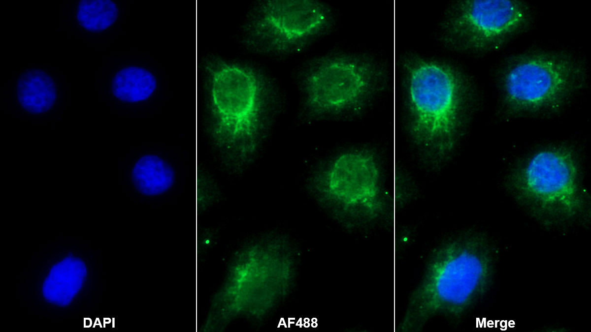 Polyclonal Antibody to Tryptase Beta 2 (TPSb2)