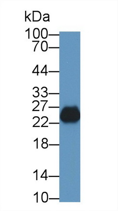 Polyclonal Antibody to Tryptase Beta 2 (TPSb2)