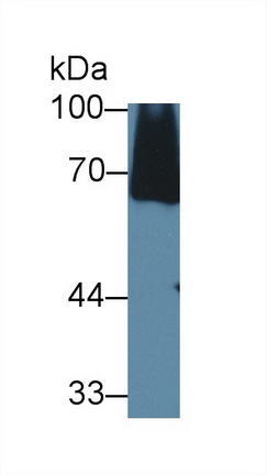 Polyclonal Antibody to Complement Component 8a (C8a)