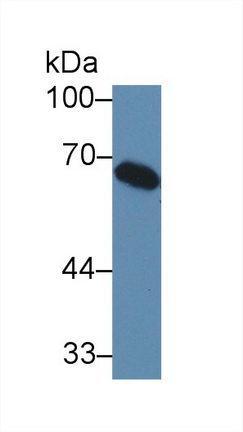 Polyclonal Antibody to Complement Component 8a (C8a)