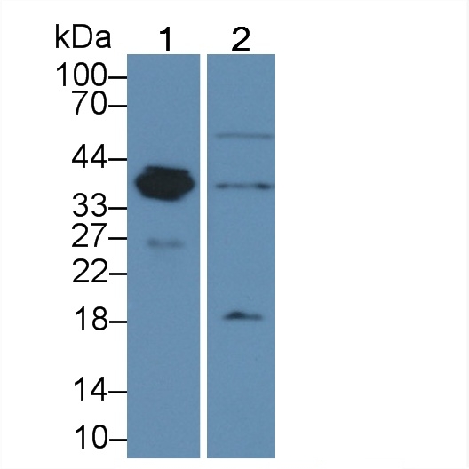 Polyclonal Antibody to Arginase II (Arg2)