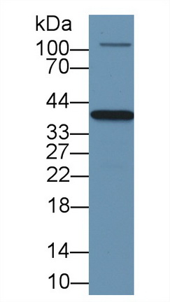 Polyclonal Antibody to Arginase II (Arg2)