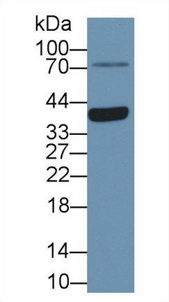 Polyclonal Antibody to Arginase II (Arg2)