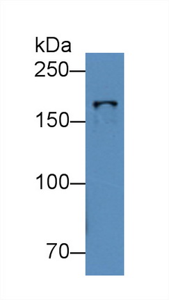 Polyclonal Antibody to Topoisomerase II Beta (TOP2b)