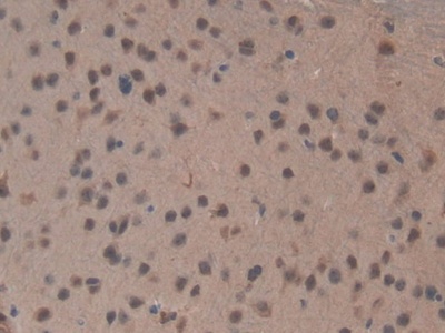 Polyclonal Antibody to Topoisomerase II Beta (TOP2b)