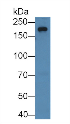 Polyclonal Antibody to Topoisomerase II Beta (TOP2b)