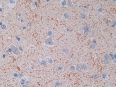 Polyclonal Antibody to Topoisomerase III (TOP3)