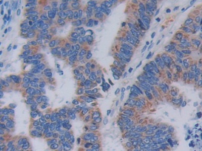 Polyclonal Antibody to Topoisomerase III (TOP3)