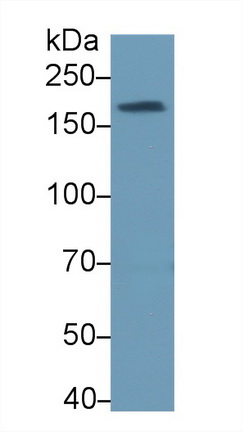 Polyclonal Antibody to Topoisomerase II Binding Protein 1 (TOPBP1)