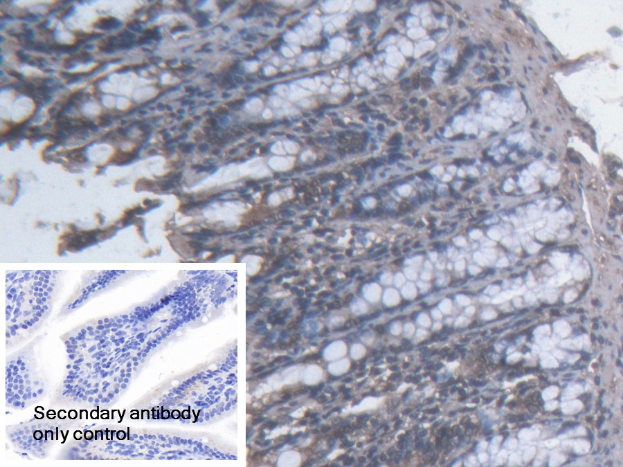 Polyclonal Antibody to Topoisomerase II Binding Protein 1 (TOPBP1)